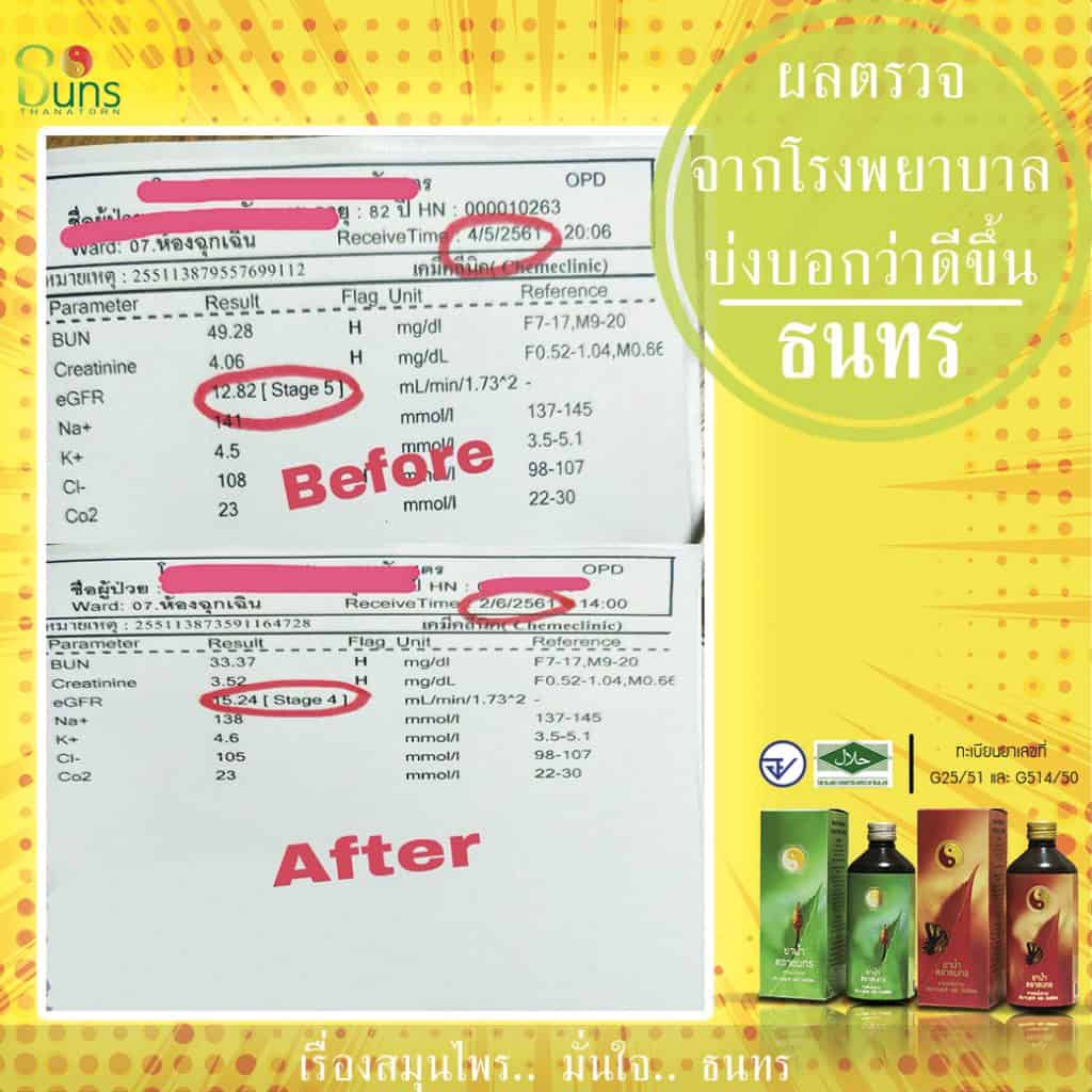 รีวิวยาน้ำสมุนไพรธนทร,สมุนไพรธนทรรีวิว,สมุนไพรธนทรดีจริงไหม,สมุนไพรธนาธร